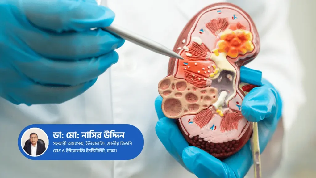 Early Signs of Kidney Disease: When Should You See a Urologist?